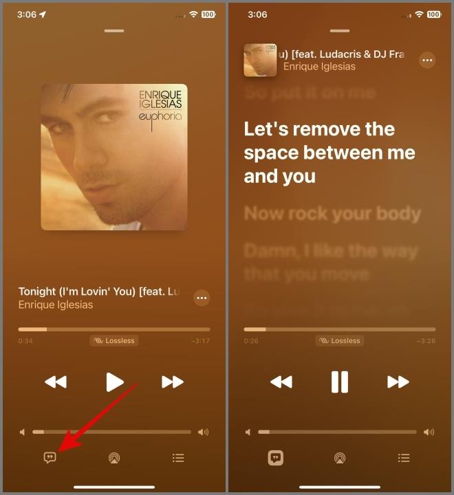 Apple Music のアイコンと記号の意味